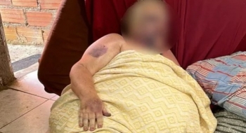 Idosa morre após ser espancada com a própria bengala pelo neto, em Aparecida de Goiânia, diz polícia